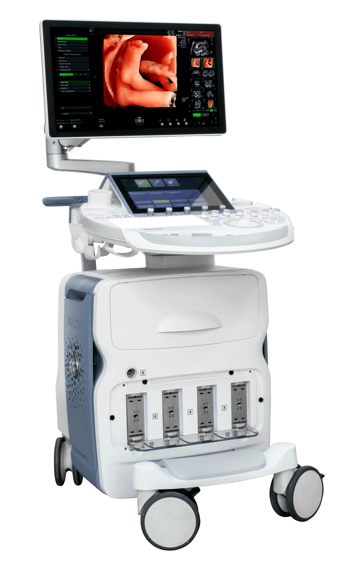 Venta equipo  de ultrasonido voluson