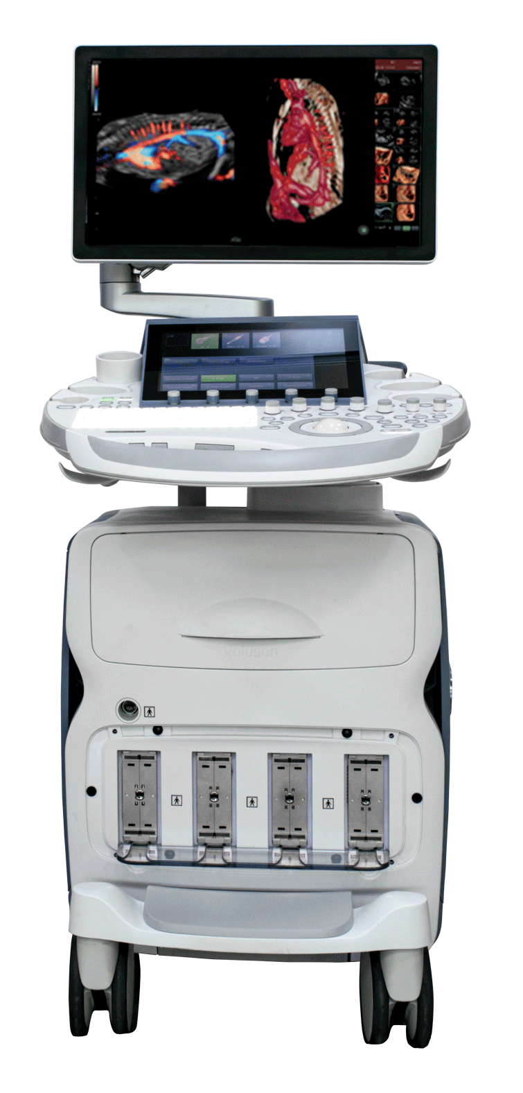 equipo de ultrasonido voluson
