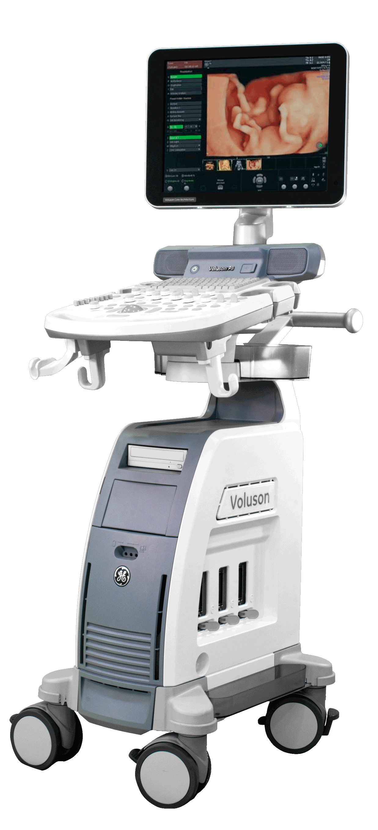 equipo de ultrasonido voluson