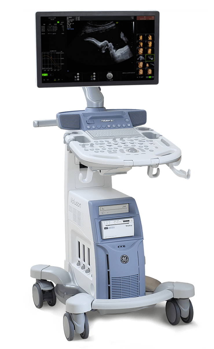 equipo de ultrasonido voluson