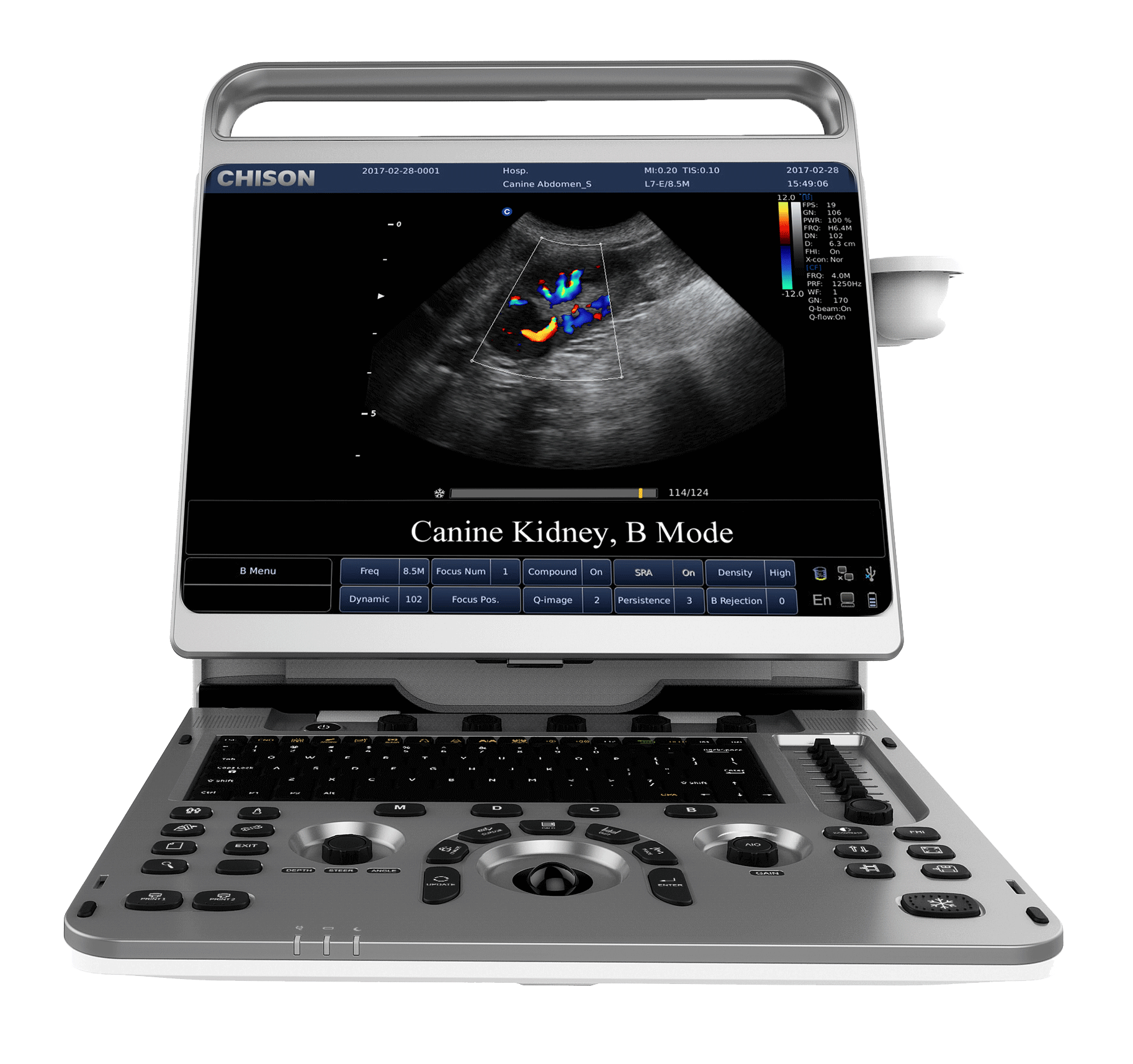 Venta chison  Ebit 30